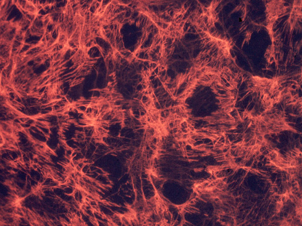 Figure 1: The fibrillar extracellular matrix surrounding cells in culture...